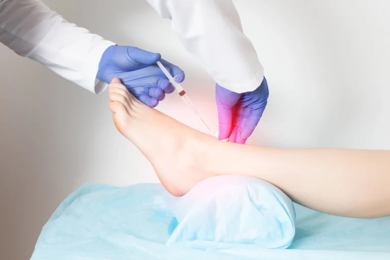stem cell therapy for ankle